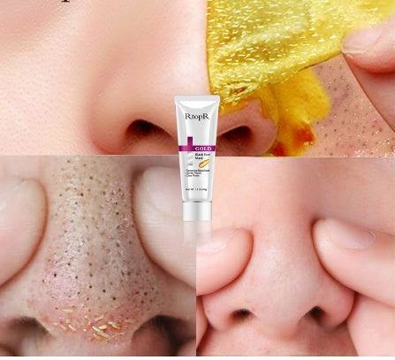 GoldPure anti-blackheads