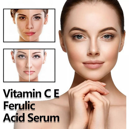 Anti - acne serum with vitamin C - DraemBox