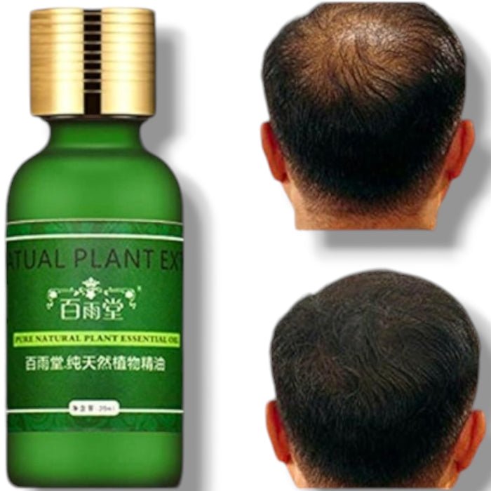 Anti - Hair Loss Hair Serum - DraemBox