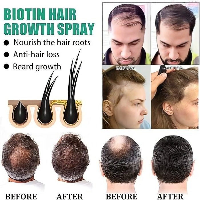 Biotin Anti Hair Loss Spray - DraemBox