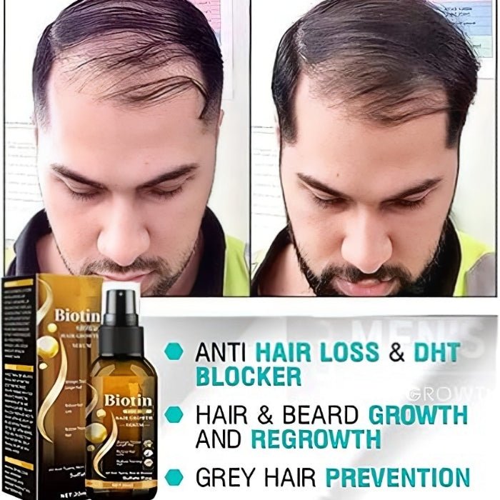 Biotin Anti Hair Loss Spray - DraemBox