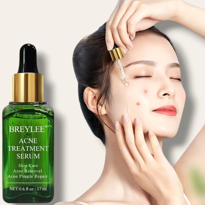 Breylee Acne Treatment Serum - DraemBox